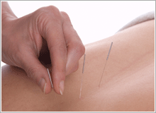 The British Medical Acupuncture Society