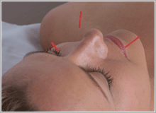 The British Medical Acupuncture Society