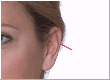 The British Medical Acupuncture Society