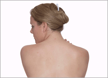 The British Medical Acupuncture Society